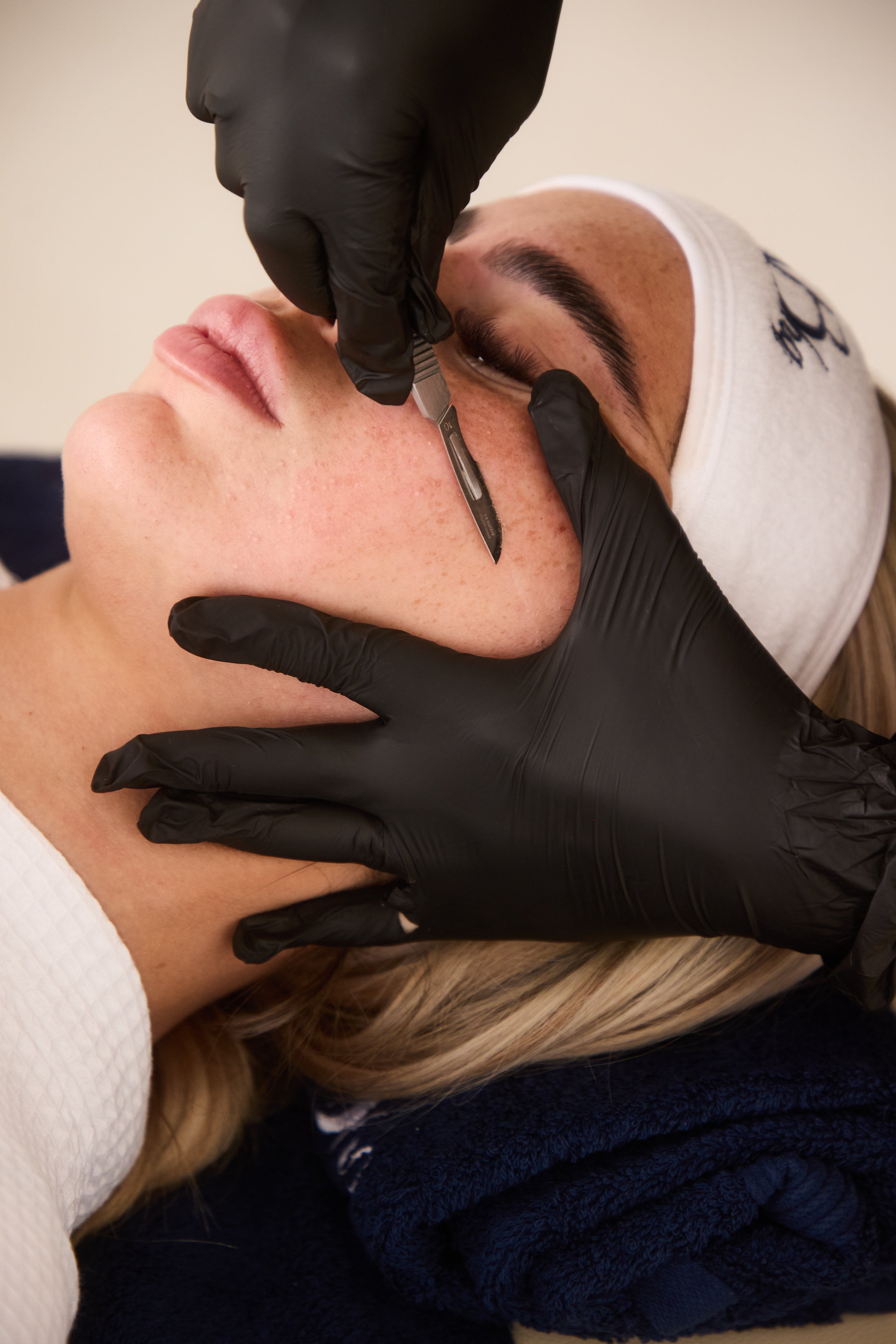 Dermaplaning