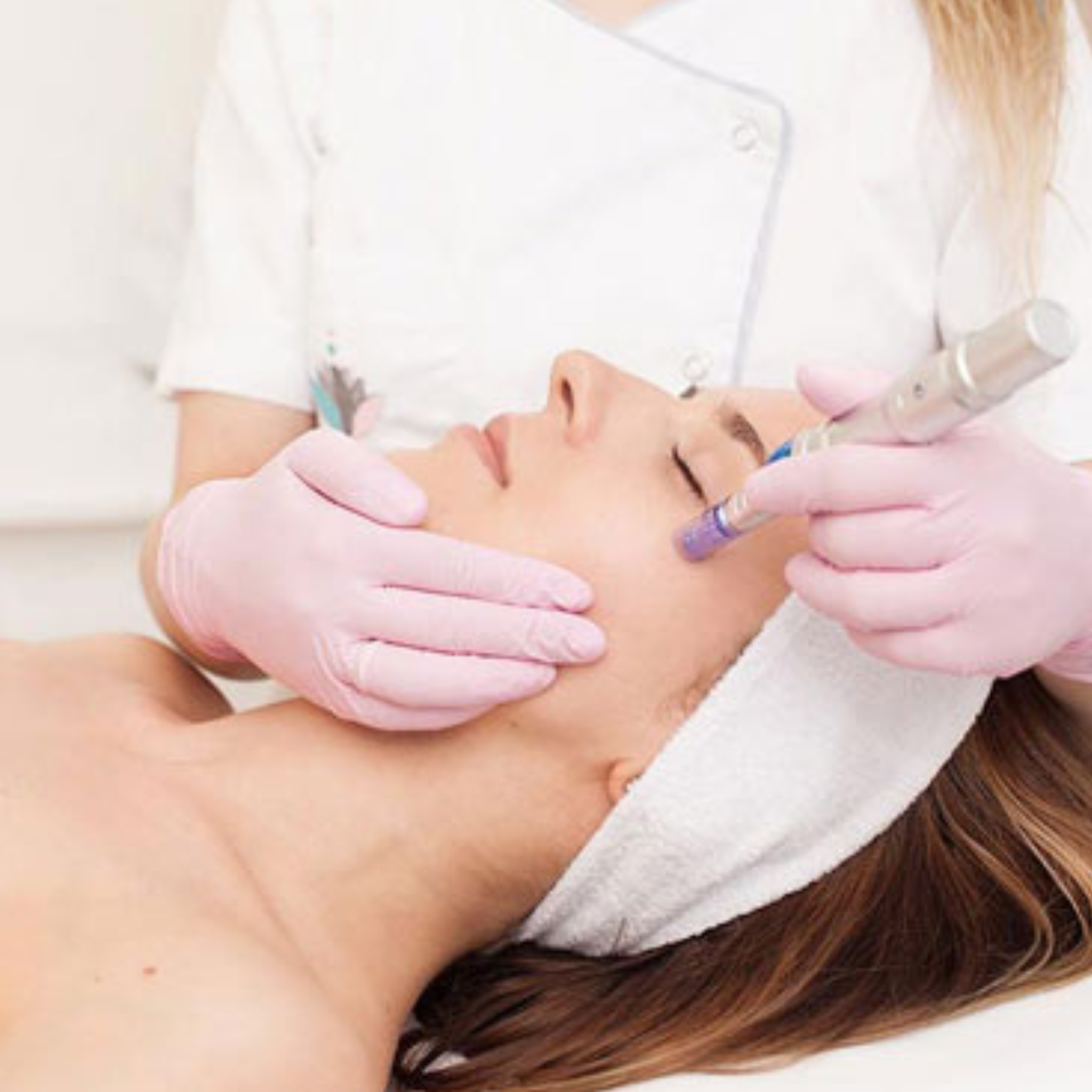 Microneedling incl. mesotherapy